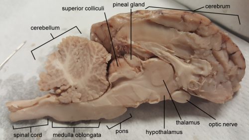 labeled brain
