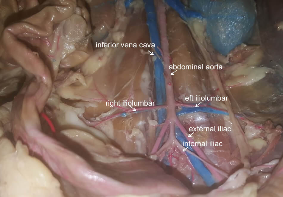 iliolumbar-artery-labeled