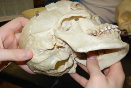 skull-occipital-condyles