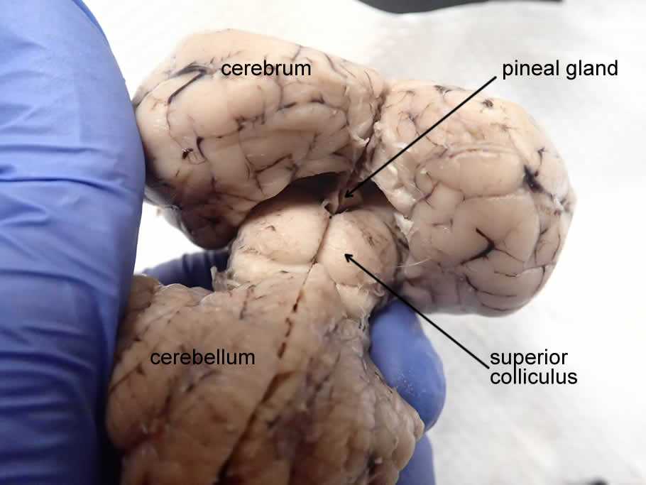 Brain Pineal Gland